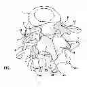 Fig. 02 - Facet Joint Replacement