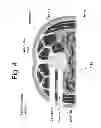 Fig. 05 - Devices and methods for spinal stabilization and instrumentation
