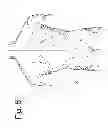 Fig. 06 - Devices and methods for spinal stabilization and instrumentation