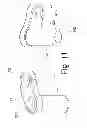 Fig. 12 - Devices and methods for spinal stabilization and instrumentation