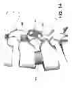 Fig. 15 - Devices and methods for spinal stabilization and instrumentation