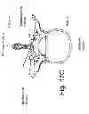 Fig. 19 - Devices and methods for spinal stabilization and instrumentation