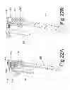 Fig. 24 - Devices and methods for spinal stabilization and instrumentation