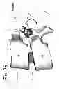 Fig. 27 - Devices and methods for spinal stabilization and instrumentation