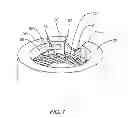 Fig. 08 - Expandable spinal implant system and method