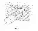 Fig. 11 - Expandable spinal implant system and method