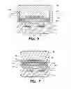 Fig. 05 - Expandable interbody fusion device