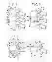 Fig. 02 - Devices for treating the spine