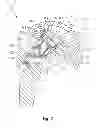Fig. 08 - Variable angle humeral components