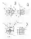 Fig. 03 - Shoulder prosthesis