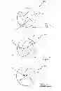 Fig. 06 - Shoulder prosthesis