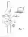 Fig. 02 - Hermetically sealed prosthetic component and method therefor