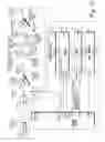 Fig. 07 - Hermetically sealed prosthetic component and method therefor