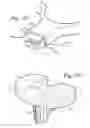 Fig. 20 - Hermetically sealed prosthetic component and method therefor