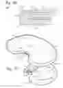 Fig. 22 - Hermetically sealed prosthetic component and method therefor