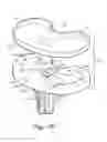 Fig. 25 - Hermetically sealed prosthetic component and method therefor