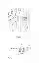 Fig. 03 - Flexible surgically implantable device, made of coated silicone, for joining phalanxes, metacarpus-phalanx or metatarsus-phalanx bones in arthroplasty surgery