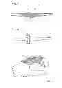 Fig. 04 - Flexible surgically implantable device, made of coated silicone, for joining phalanxes, metacarpus-phalanx or metatarsus-phalanx bones in arthroplasty surgery