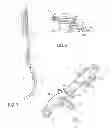 Fig. 03 - Lateral ankle fusion plate system and jig, and method for use therewith