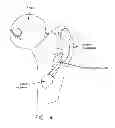 Fig. 05 - Method and apparatus for accessing the interior of a hip joint, including the provision and use of a novel telescoping access cannula and a novel telescoping obturator