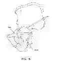 Fig. 06 - Method and apparatus for accessing the interior of a hip joint, including the provision and use of a novel telescoping access cannula and a novel telescoping obturator