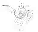 Fig. 16 - Method and apparatus for accessing the interior of a hip joint, including the provision and use of a novel telescoping access cannula and a novel telescoping obturator