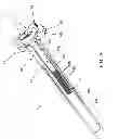 Fig. 33 - Method and apparatus for accessing the interior of a hip joint, including the provision and use of a novel telescoping access cannula and a novel telescoping obturator