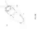 Fig. 37 - Method and apparatus for accessing the interior of a hip joint, including the provision and use of a novel telescoping access cannula and a novel telescoping obturator
