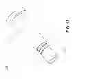 Fig. 48 - Method and apparatus for accessing the interior of a hip joint, including the provision and use of a novel telescoping access cannula and a novel telescoping obturator