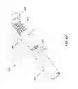Fig. 52 - Method and apparatus for accessing the interior of a hip joint, including the provision and use of a novel telescoping access cannula and a novel telescoping obturator