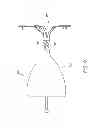 Fig. 10 - Articulable anchor