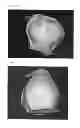Fig. 10 - SCAFFOLDS FOR ORGAN RECONSTRUCTION AND AUGMENTATION