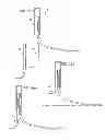 Fig. 06 - Prosthetic foot with modular construction