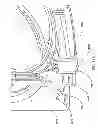 Fig. 101 - Product dispensing system