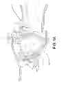Fig. 32 - HIGH EFFICIENCY, SMOOTH ROBOT DESIGN