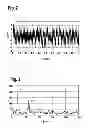 Fig. 03 - METHOD FOR DIAGNOSING A SUPERCHARGING SYSTEM OF INTERNAL COMBUSTION ENGINES