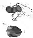 Fig. 05 - Method and system for patient-specific modeling of blood flow