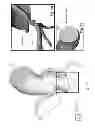 Fig. 11 - Method and system for patient-specific modeling of blood flow