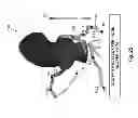 Fig. 15 - Method and system for patient-specific modeling of blood flow
