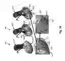Fig. 21 - Method and system for patient-specific modeling of blood flow