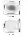 Fig. 04 - Method for calibrating and correcting the scanning distortion of an optical coherence tomography system