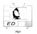 Fig. 07 - MEDICAL IMAGE PROCESSING APPARATUS, A MEDICAL IMAGE PROCESSING METHOD, AND ULTRASONIC DIAGNOSIS APPARATUS