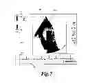Fig. 08 - MEDICAL IMAGE PROCESSING APPARATUS, A MEDICAL IMAGE PROCESSING METHOD, AND ULTRASONIC DIAGNOSIS APPARATUS