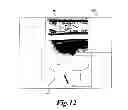 Fig. 13 - MEDICAL IMAGE PROCESSING APPARATUS, A MEDICAL IMAGE PROCESSING METHOD, AND ULTRASONIC DIAGNOSIS APPARATUS