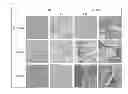 Fig. 02 - METHODS OF GENERATING XENOCHIMAERIC MICE WITH TUMOR AND HEMATOPOIETIC SYSTEM FROM THE SAME HETEROLOGOUS SPECIES