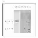 Fig. 03 - METHODS OF GENERATING XENOCHIMAERIC MICE WITH TUMOR AND HEMATOPOIETIC SYSTEM FROM THE SAME HETEROLOGOUS SPECIES