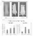 Fig. 06 - METHODS OF GENERATING XENOCHIMAERIC MICE WITH TUMOR AND HEMATOPOIETIC SYSTEM FROM THE SAME HETEROLOGOUS SPECIES