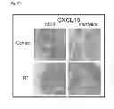 Fig. 26 - METHODS OF GENERATING XENOCHIMAERIC MICE WITH TUMOR AND HEMATOPOIETIC SYSTEM FROM THE SAME HETEROLOGOUS SPECIES