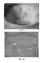 Fig. 08 - Processing Cocoa Beans And Other Seeds