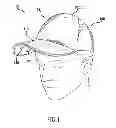 Fig. 02 - Speaker hat
